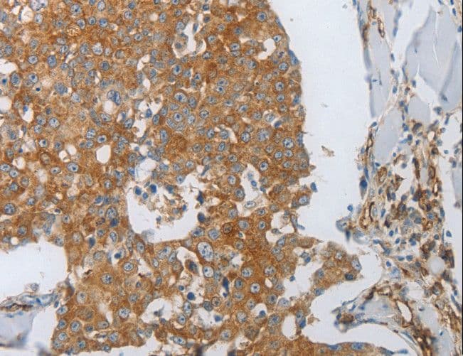 PECAM-1 / CD31 Antibody