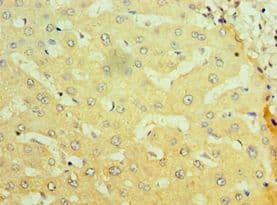 NR1I2 / PXR Antibody (aa175-434)
