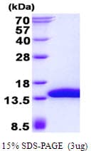 Human SH3BGRL3 Protein (Recombinant His)