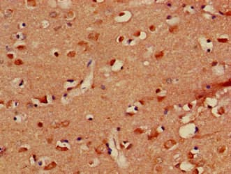 Polyclonal Rabbit anti-Human PLXND1 / Plexin D1 Antibody (IHC, IF)