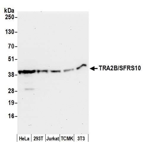 TRA2B / SFRS10 Antibody (aa1-50)