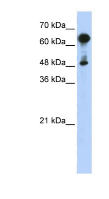 Polyclonal Rabbit anti-Human HSPA6 / HSP70B' Antibody (C-Terminus, WB)