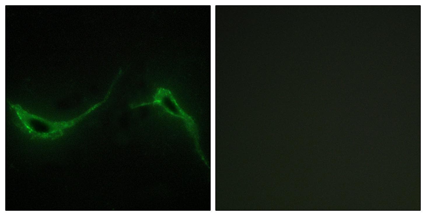 ADCY7 / Adenylate Cyclase 7 Antibody