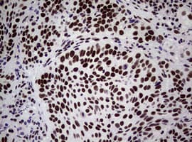 NBN / Nibrin Antibody (clone OTI6H7)
