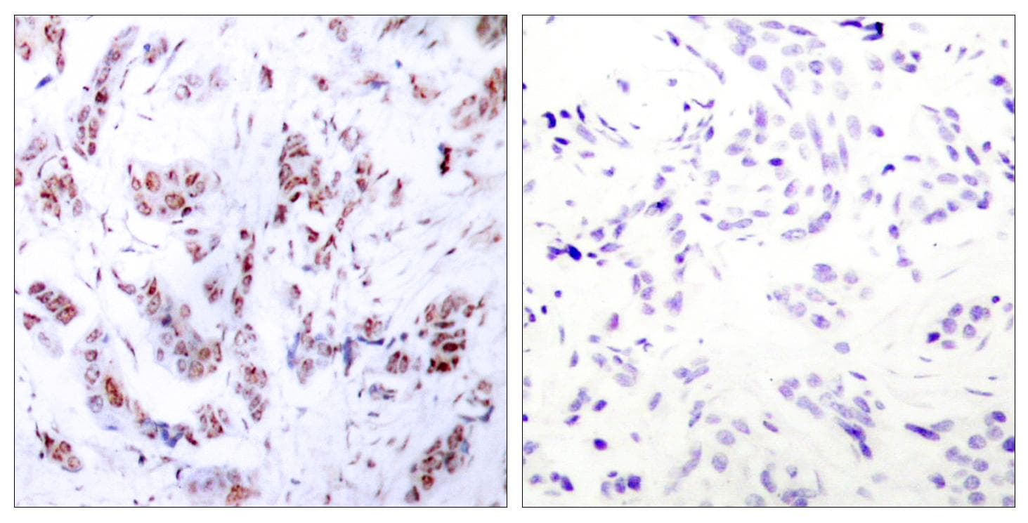 MEF2A / MEF2 Antibody (p312)
