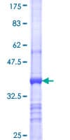 Human SBF2 Protein (Recombinant GST, N-terminus)
