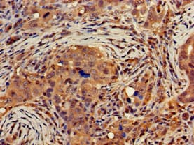 IHC-plus™ DGAT1 Antibody (aa1-62)