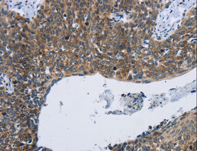 Polyclonal Rabbit anti-Human KPNB1 / Importin Beta Antibody (IHC)