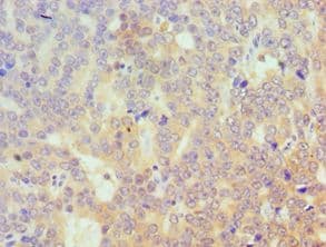 TRIM27 Antibody (aa214-513)