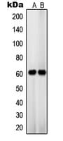 Polyclonal Rabbit anti-Human SLC22A3 / OCT3 Antibody (Internal, WB)