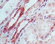 DNMT3L Antibody (aa130-180)