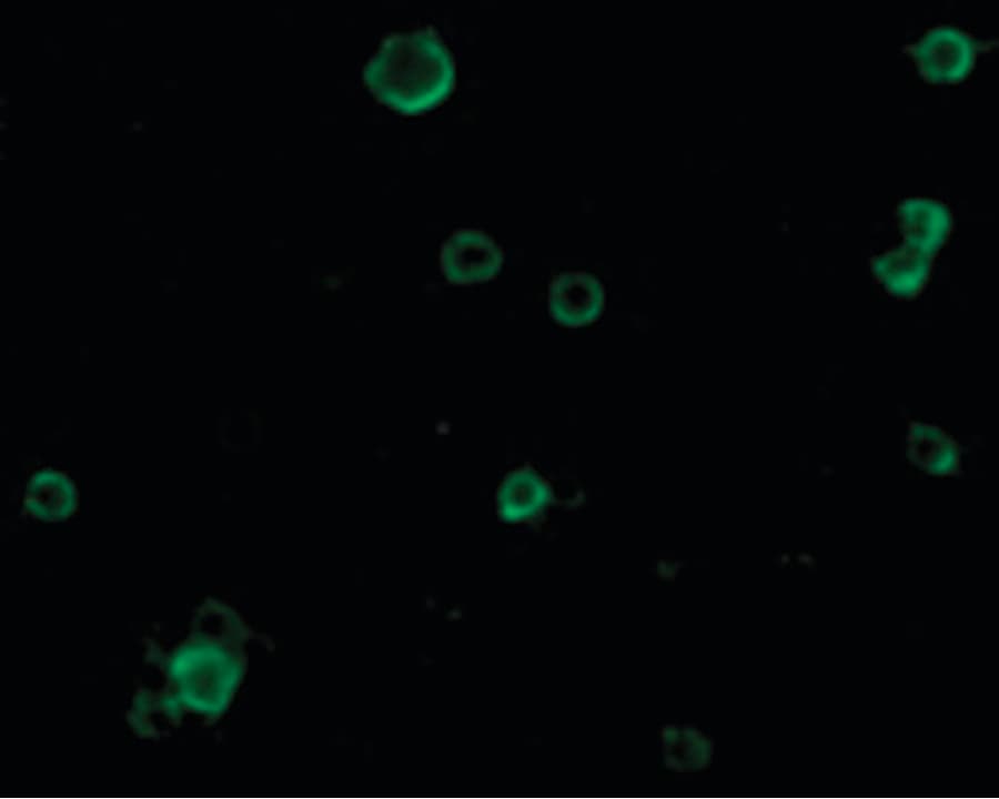 ADAM17 / TACE Antibody