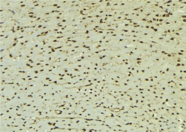 Polyclonal Rabbit anti-Human TLE1 / TLE 1 Antibody (IHC, WB)
