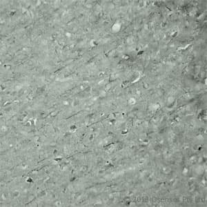 Polyclonal Rabbit anti-Human SYT17 Antibody (Internal, IHC, WB)