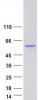Human TP73 / p73 Protein (Recombinant Myc-DDK (Flag))