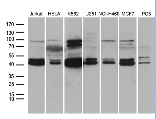 Monoclonal Mouse anti-Human NFKBIE / IKB Epsilon Antibody (clone OTI4F7, WB)