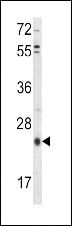 Polyclonal Rabbit anti-Human TIMP3 Antibody (aa113-139, IHC, WB)