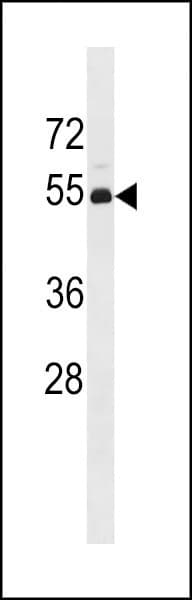 Polyclonal Rabbit anti-Human TP53 / p53 Antibody (aa1-30, WB)