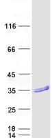 Human RAB37 Protein (Recombinant Myc-DDK (Flag))