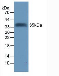 TMEFF2 Antibody (aa52-290, PE)
