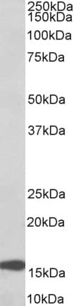 IHC-plus™ RPL23 / Ribosomal Protein L23 Antibody (aa123-135)