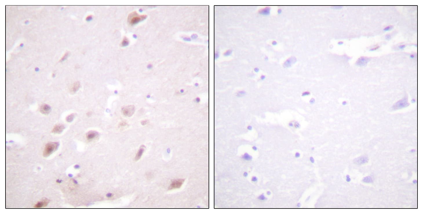 Polyclonal Rabbit anti-Human CSNK2B / Phosvitin Antibody (phospho-Ser209, IHC, WB)
