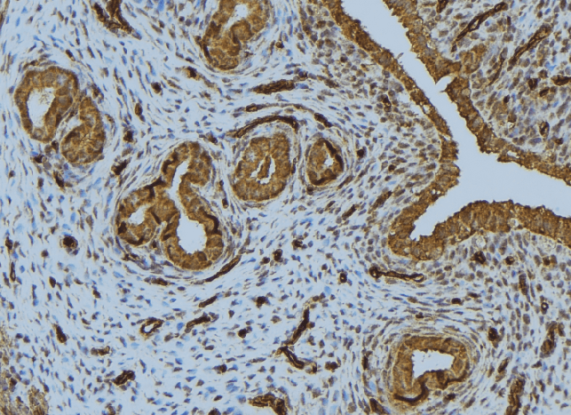 IFN Beta / Interferon Beta Antibody