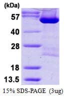 Human DARS Protein (Recombinant His)