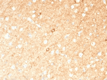 GAD1 / GAD67 Antibody (clone GAD1/2391)