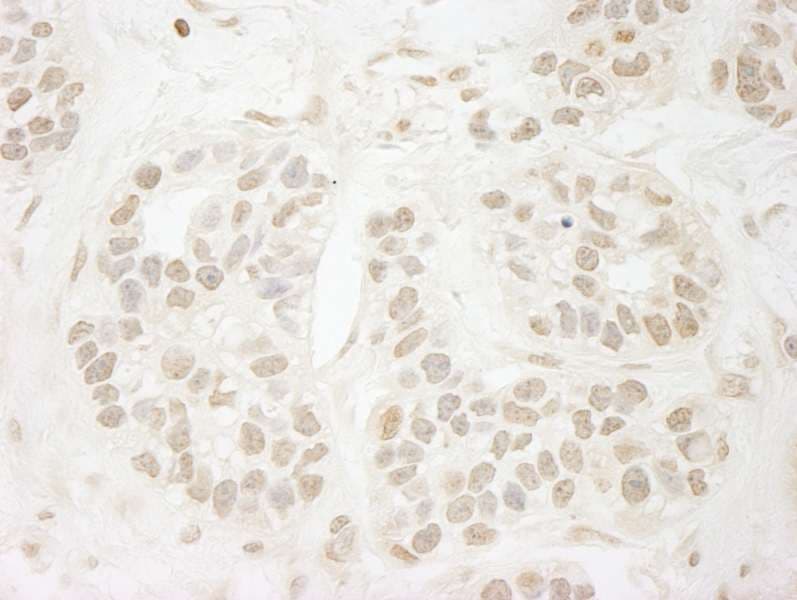 Polyclonal Rabbit anti-Human PPP3CA / CCN1 / Calcineurin A Antibody (aa470-C-term, IHC)