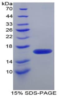 Human FKBP1B / FKBP12.6 Protein (Recombinant His)
