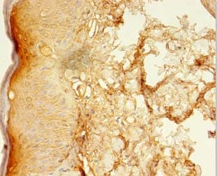 LSMEM2 / C3orf45 Antibody