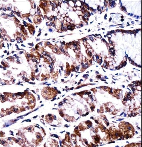 PPEF2 Antibody (aa304-333)