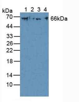KRT1 / CK1 / Cytokeratin 1 Antibody (aa487-644, Biotin)