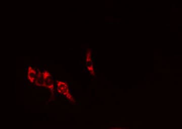 IL10RA Antibody