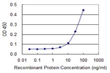 HBG1 / Fetal Hemoglobin Antibody (clone 1G8)