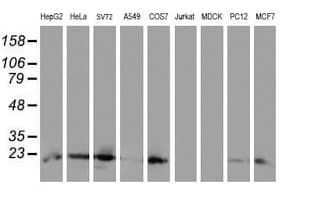 UBE2E3 Antibody (clone OTI6D10)