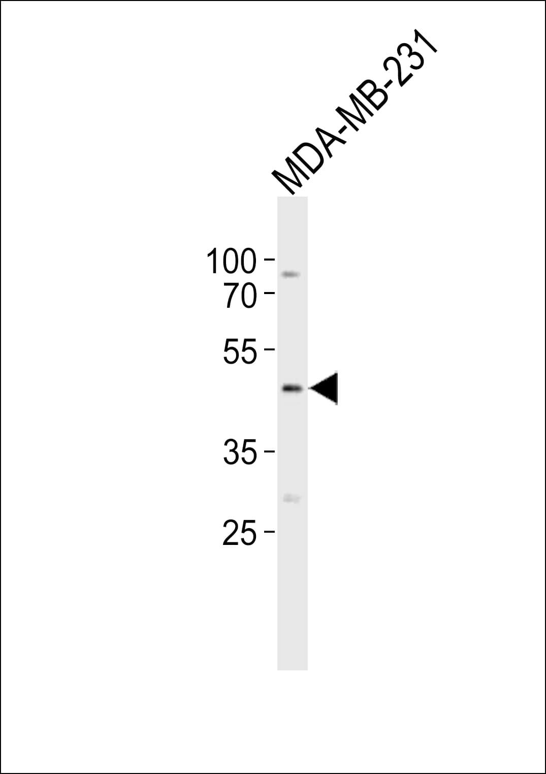 LPAR2 / EDG4 Antibody (aa3-32)