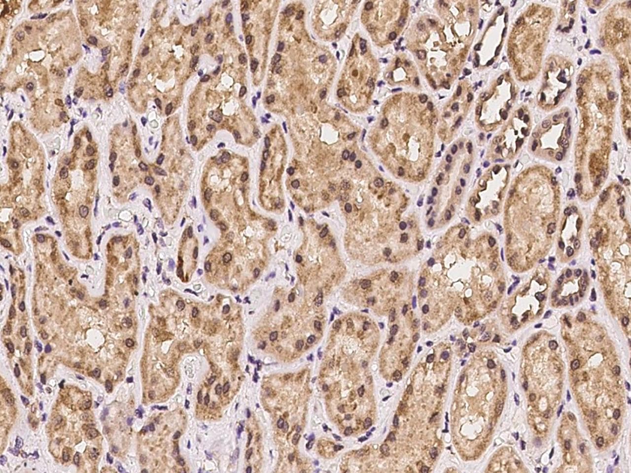 Polyclonal Rabbit anti-Human UCHL5 / UCH37 Antibody (IHC)