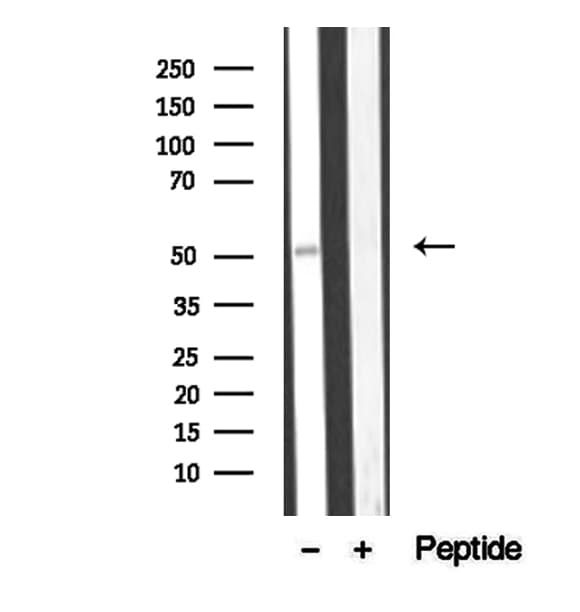 Polyclonal Rabbit anti-Human BBS4 Antibody (IHC, WB)