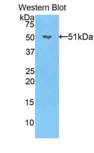 NOG / Noggin Antibody (aa28-232)