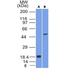 SOX10 Antibody (clone SOX10/1074)