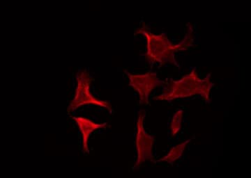 CRHR2 / CRF2 Receptor Antibody