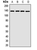 Polyclonal Rabbit anti-Human OPLAH Antibody (WB)