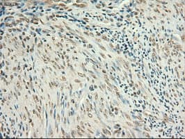Monoclonal Mouse anti-Human MYC / c-Myc Antibody (clone OTI1A6, IHC, IF, WB)