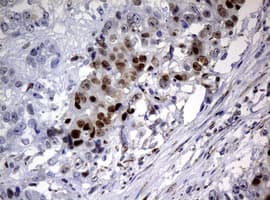 Monoclonal Mouse anti-Human PCNA Antibody (clone OTI1D11, IHC, WB)