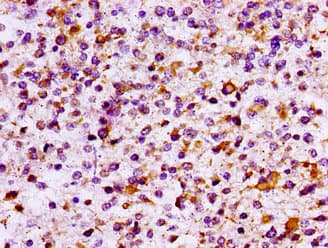 IL10RB Antibody