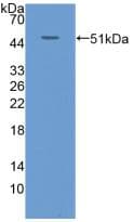 KRT20 / CK20 / Cytokeratin 20 Antibody (aa9-424)