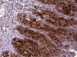 GSTP1 / GST Pi Antibody (clone OTI4B6, Carrier-free)
