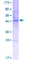 Human ANKRD10 Protein (Recombinant GST)